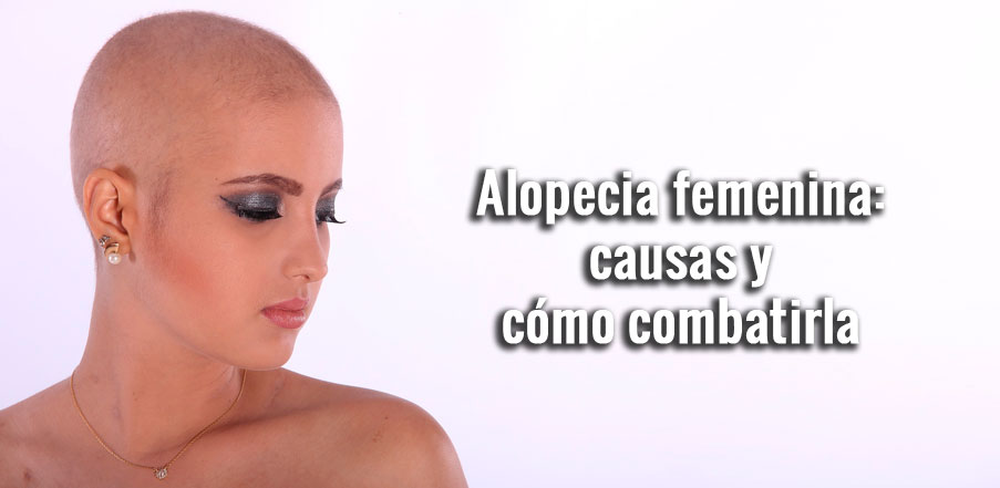 causas de la alopecia femenina
