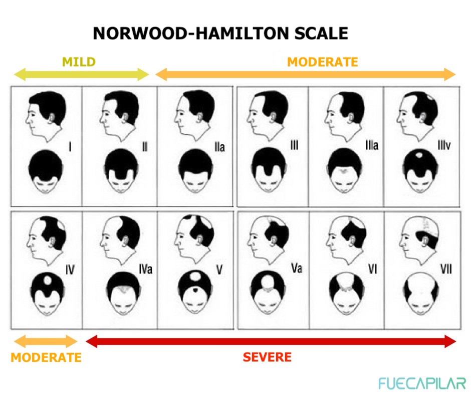hamilton-scale